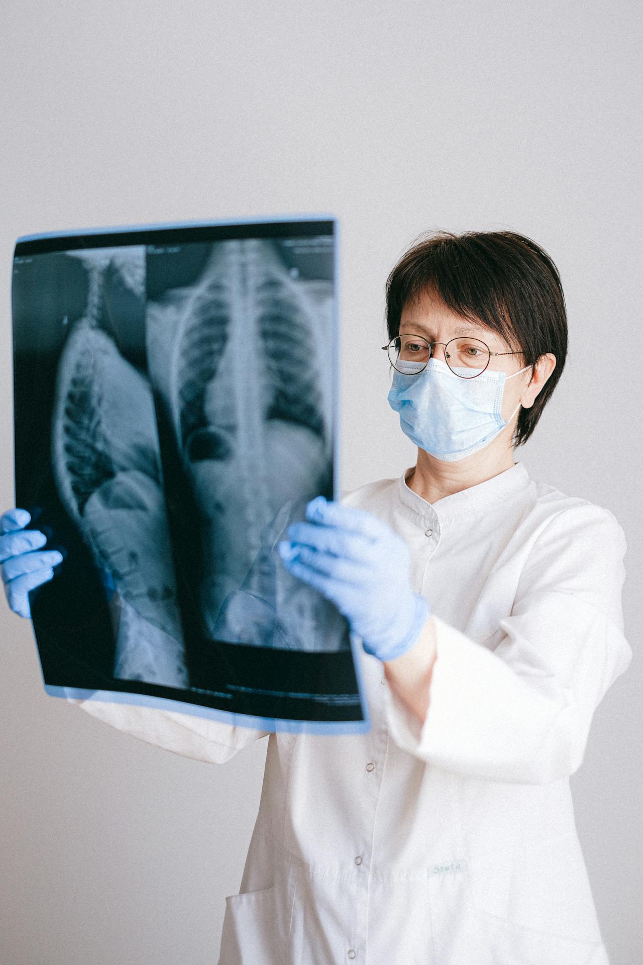 X-Rays at Ann Arbor Urgent Care